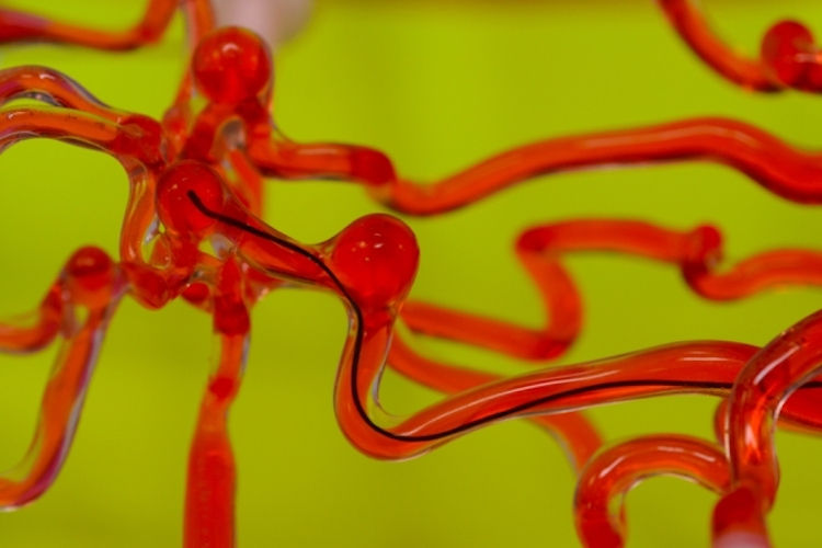 MIT develops thread-like robot that can slip through brain’s blood vessels