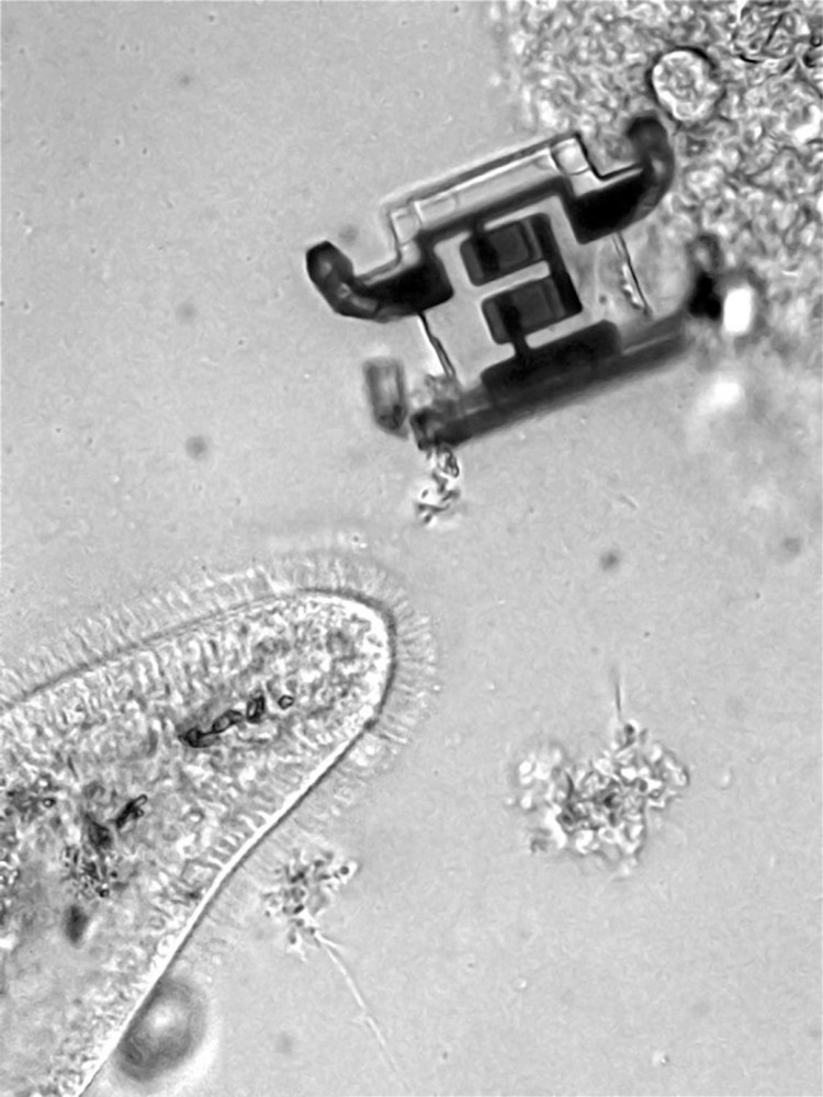 Millions of microscopic robots could be used to fight diseases inside the body