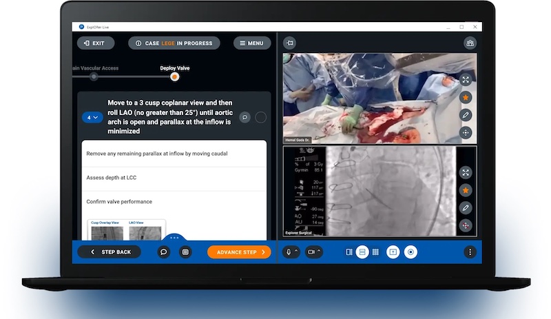 Explorer Surgical expands its digital platform into robotic surgery